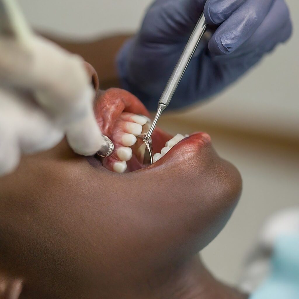 image_fx_implant_in_dental_care_on_naturel_black_patie (2) - New Smile Clinic Lubumbashi