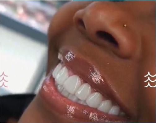 IMG-20241016-WA0022 - New Smile Clinic Lubumbashi